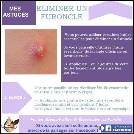 Comment traiter un furoncle du fessier